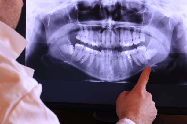 Best Emergency Dental Extractions in Asheboro, NC
