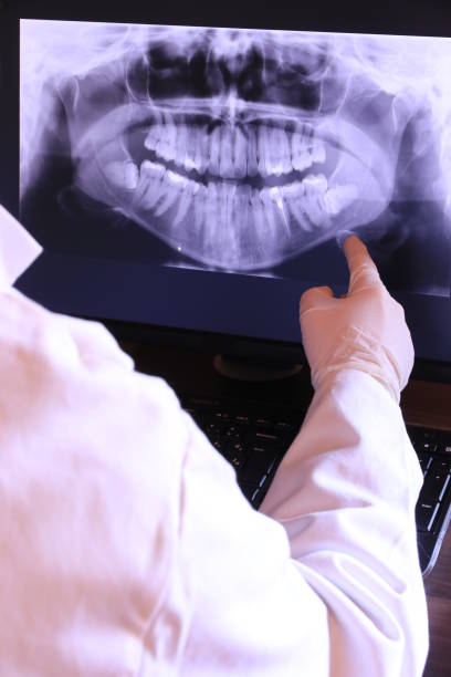 Best Emergency Dentist for Lost Fillings or Crowns in Asheboro, NC