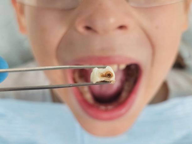 Best Weekend Emergency Dentist in Asheboro, NC
