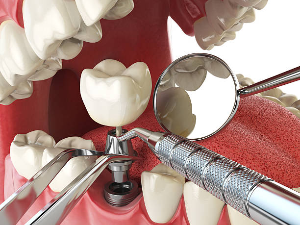 Best Mobile Emergency Dentist in Asheboro, NC